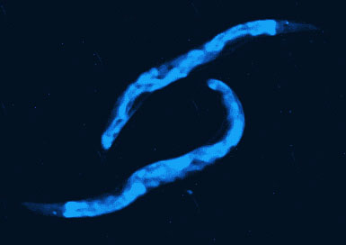 Early Cancer Detection Project