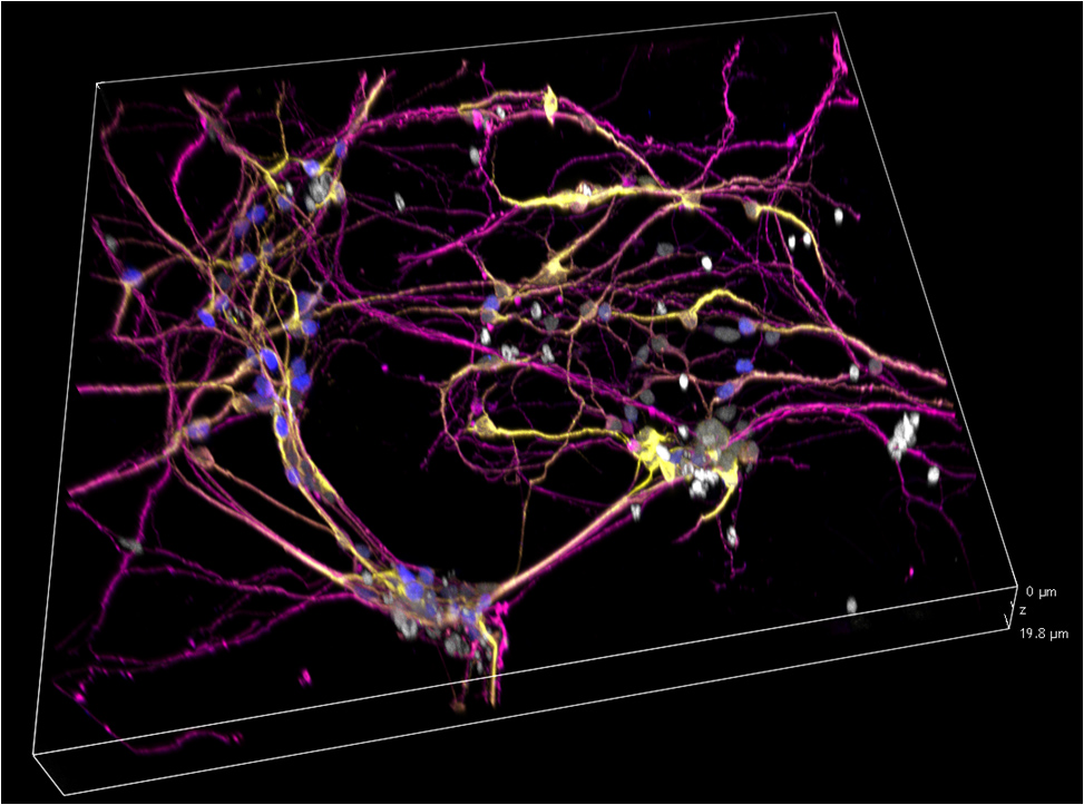 Advanced Tau Protein Detection