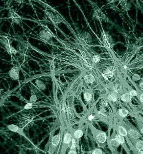 Retinal imaging for Alzheimer’s detection