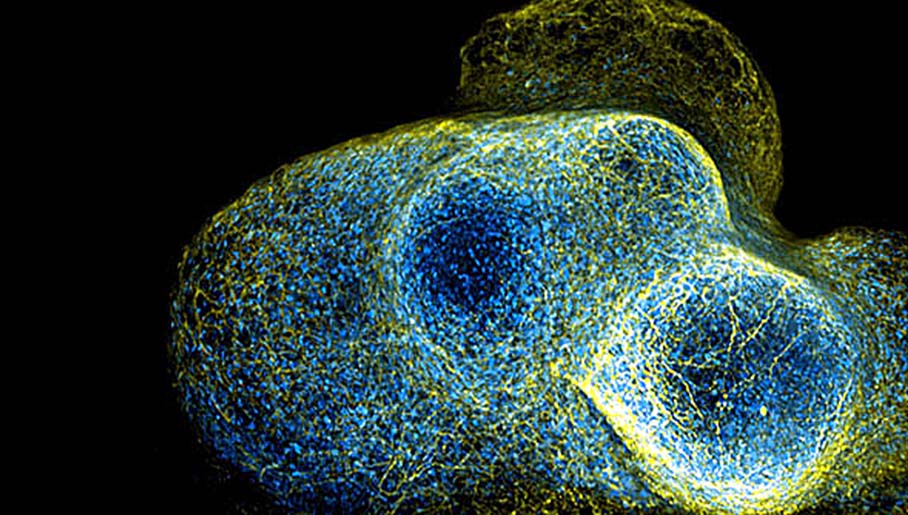 Join Us for a Live Webinar on October 11, 2023